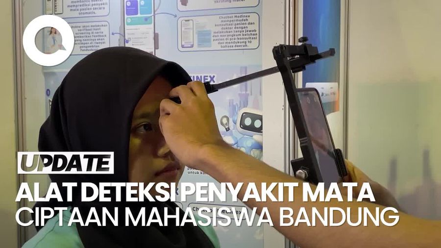 Video: Mahasiswa Bandung Ini Ciptakan Alat Deteksi Dini Penyakit Mata Berbasis AI