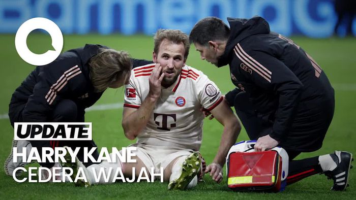 Video Bayern Vs Celtic, Kompany Beberkan Kondisi Cedera Harry Kane