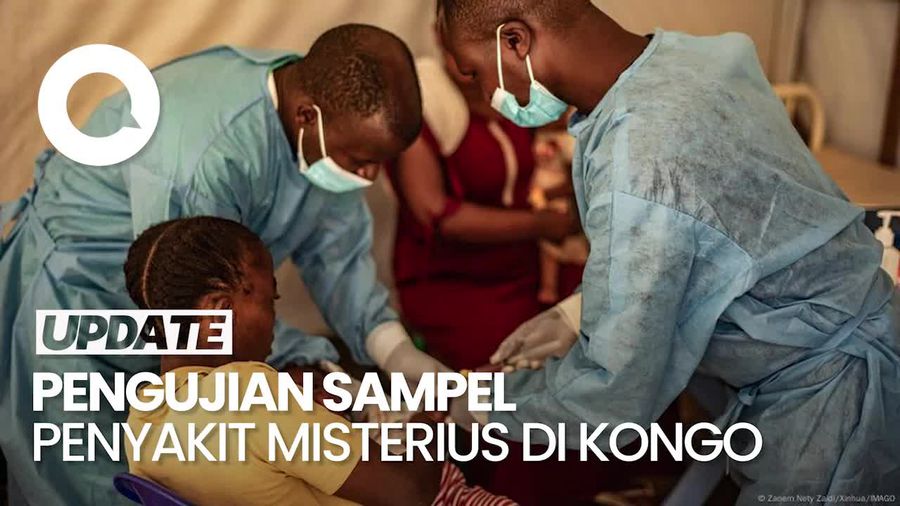 Video Hasil Uji Sampel Pasien Terjangkit Penyakit Misterius di Kongo