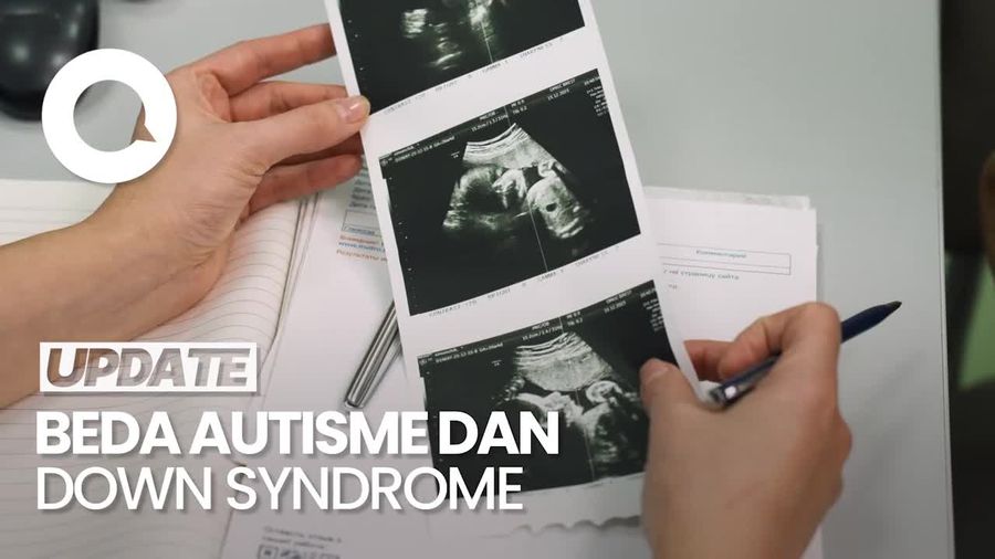 Video: Penjelasan Dokter soal Perbedaan Autisme dan Down Syndrome