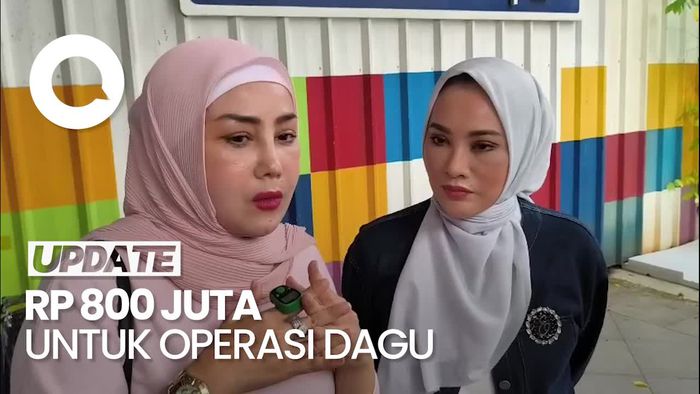 Video Rency Milano Habiskan Rp 800 Juta untuk Operasi Plastik
