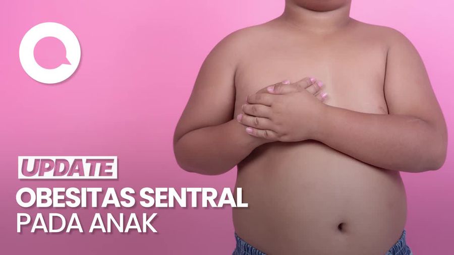 Video: Dokter Ungkap Penyebab Anak Alami Obesitas Sentral