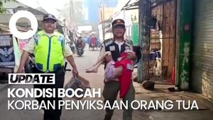 Video: Polri-Komnas Anak Jenguk Bocah Korban Penyiksaan Orang Tua di Jaksel