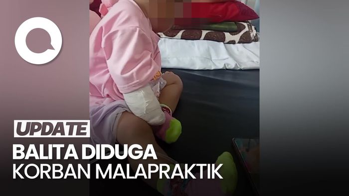 Video Nestapa Balita di Bima: Diduga Kena Malapraktik Berujung Tangan Diamputasi