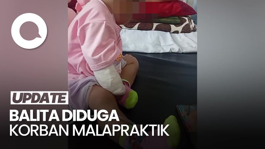 Video Nestapa Balita di Bima: Diduga Kena Malapraktik Berujung Tangan Diamputasi