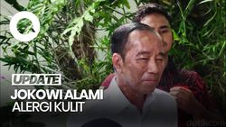 Video Jokowi soal Kena Alergi Kulit: Baik dalam Pemulihan