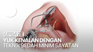 Video: Pernah Dengar Laparoskopi? Ini Kata Dokter soal Keunggulannya