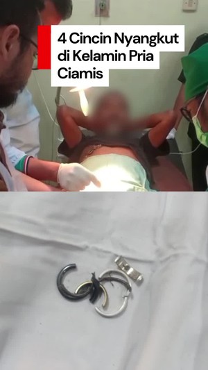 Video: Momen Damkar Evakuasi 4 Cincin Nyangkut di Kelamin Pria di Ciamis