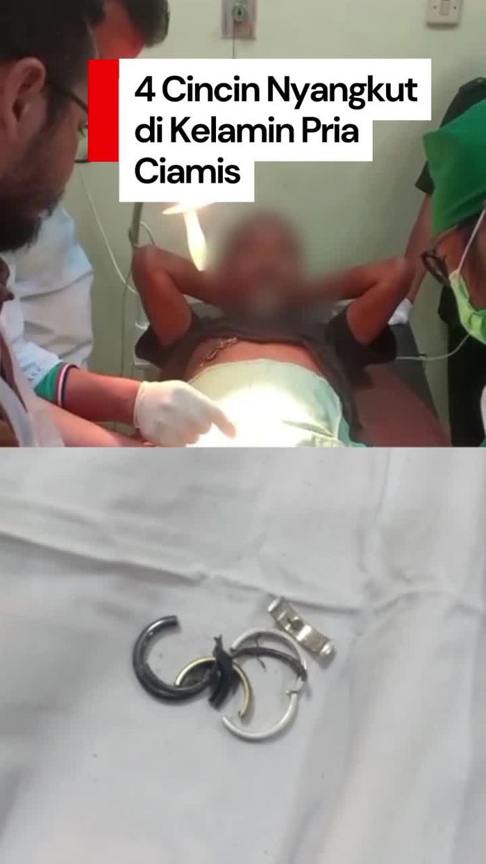 Video: Momen Damkar Evakuasi 4 Cincin Nyangkut di Kelamin Pria di Ciamis