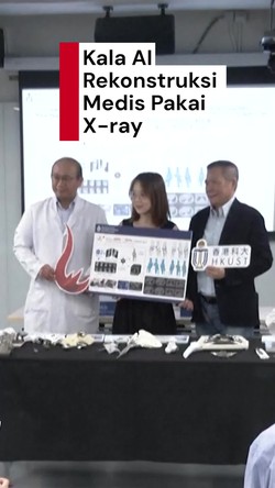 Video: Canggih! Hong Kong Kembangkan AI untuk Rekonstruksi Medis X-ray