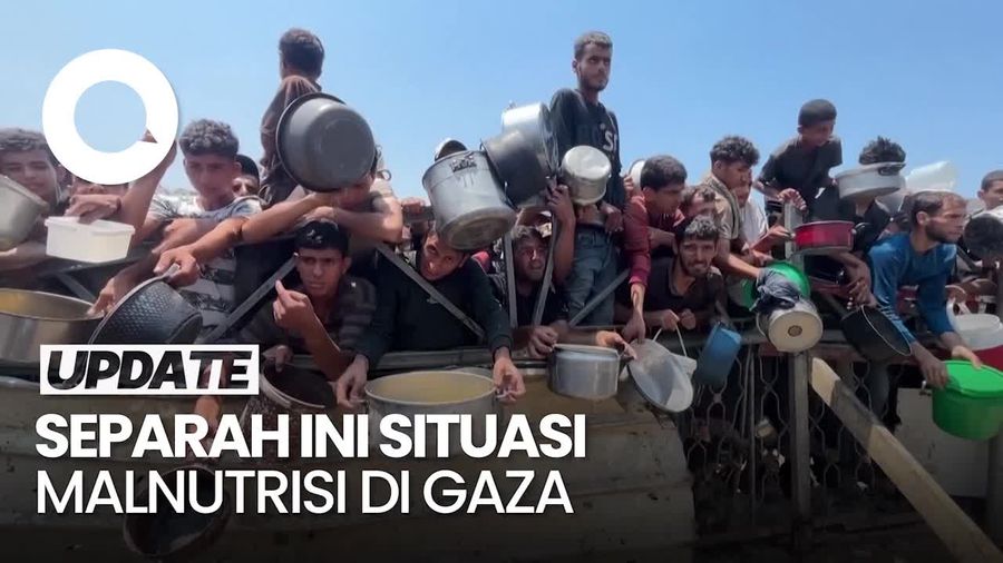 Video: Warga Gaza Malnutrisi Parah, Sampai Makanan Harus Dikenalkan Ulang
