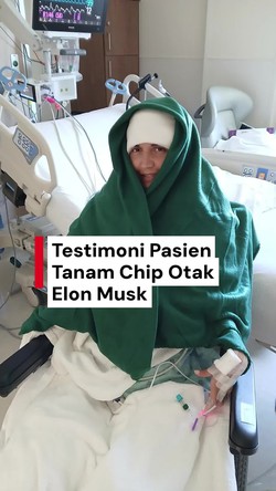 Video: Pasien Chip Otak Elon Musk Pamer Aksi Kendalikan Komputer Pakai Pikiran