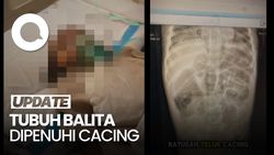 Video: Kisah Pilu Raya, Balita yang Tewas dengan Tubuh Dipenuhi Cacing