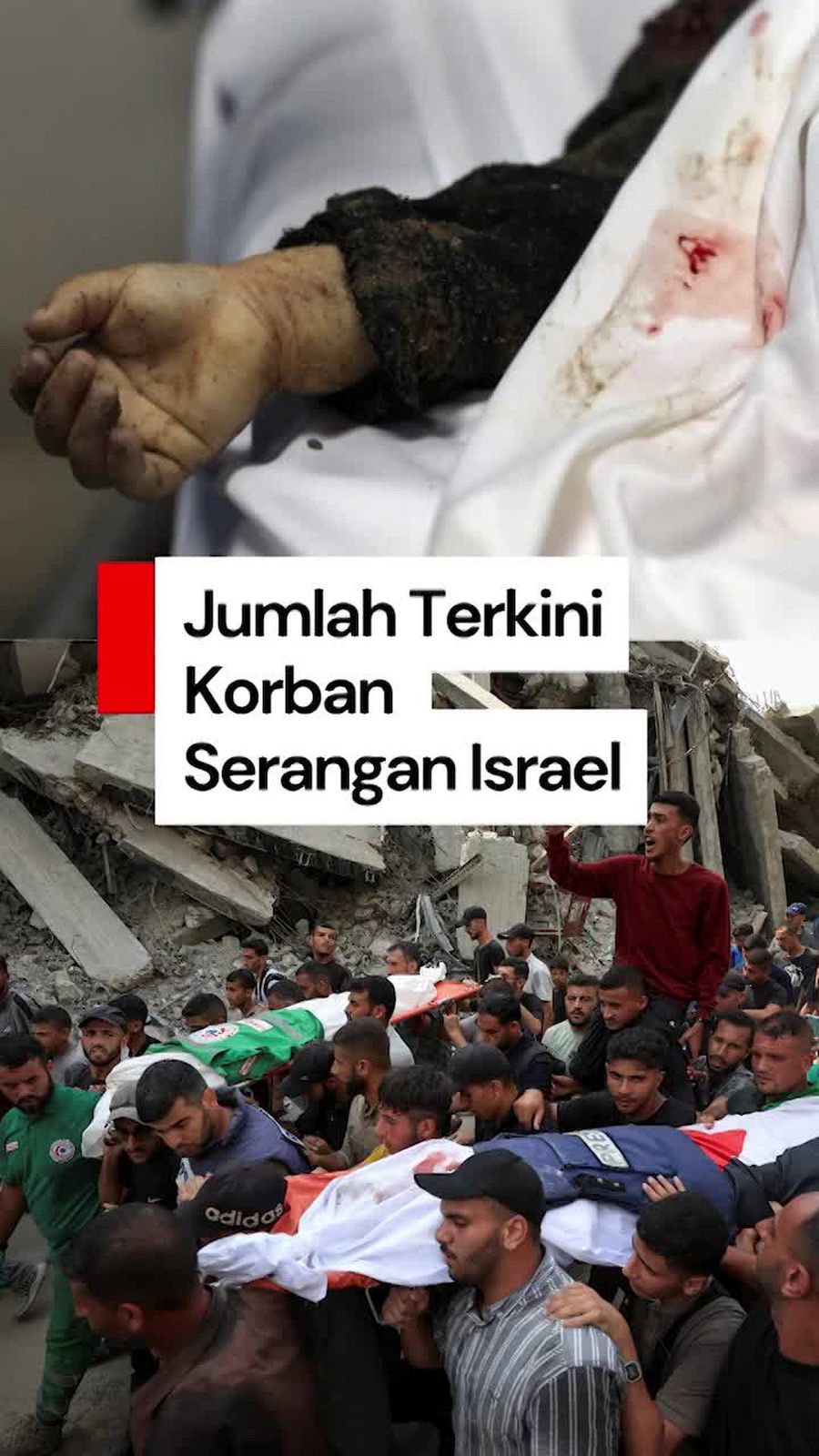 Video: Korban Warga Palestina Akibat Israel Sudah 62 Ribu Jiwa