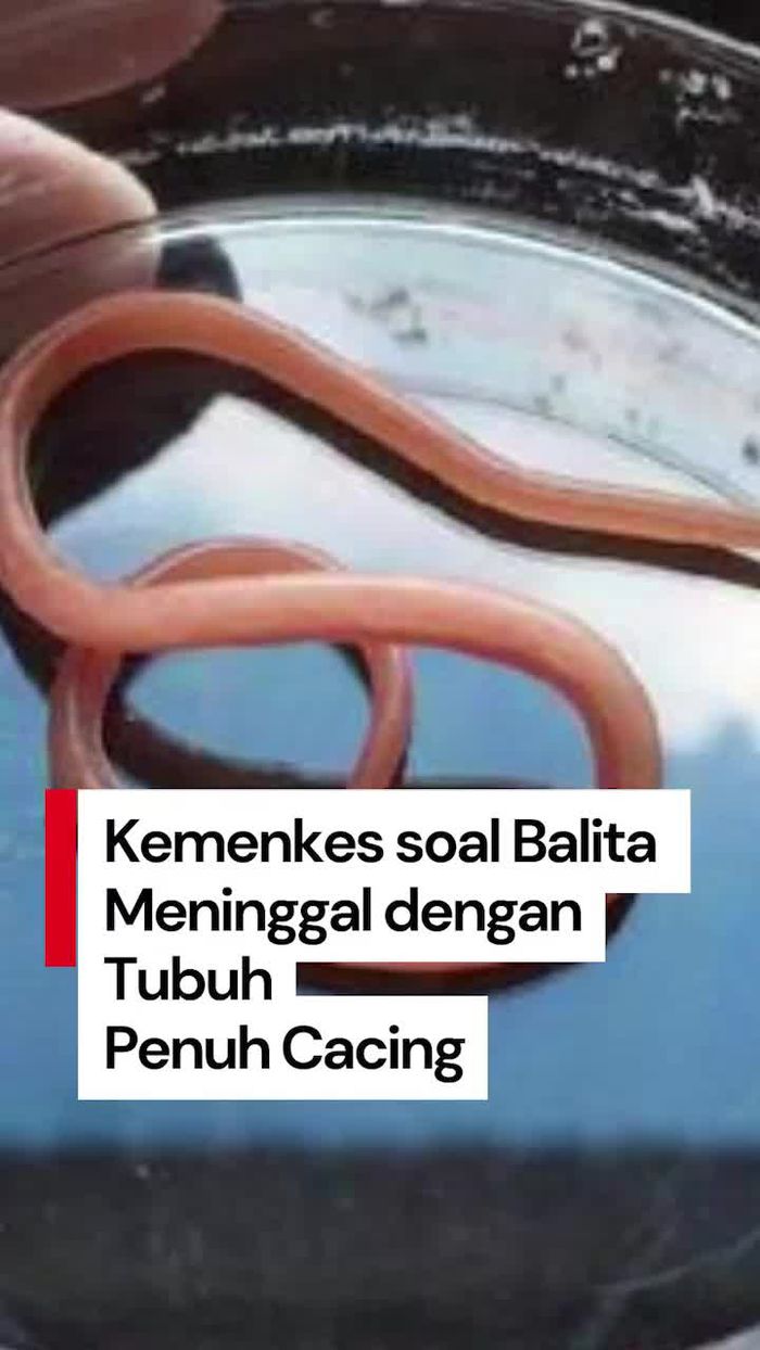 Video: Kemenkes soal Balita di Sukabumi Meninggal dengan Tubuh Penuh Cacing