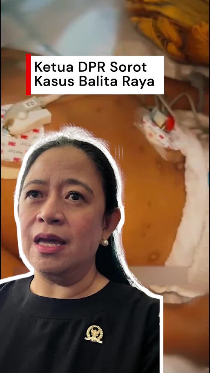 Video Puan soal Kasus Balita Raya di Sukabumi: Posyandu Harusnya Proaktif