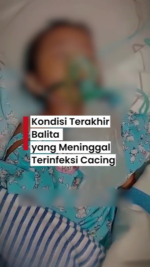 Video: Kondisi Terakhir Raya Sebelum Meninggal Terinfeksi Cacing di Sukabumi