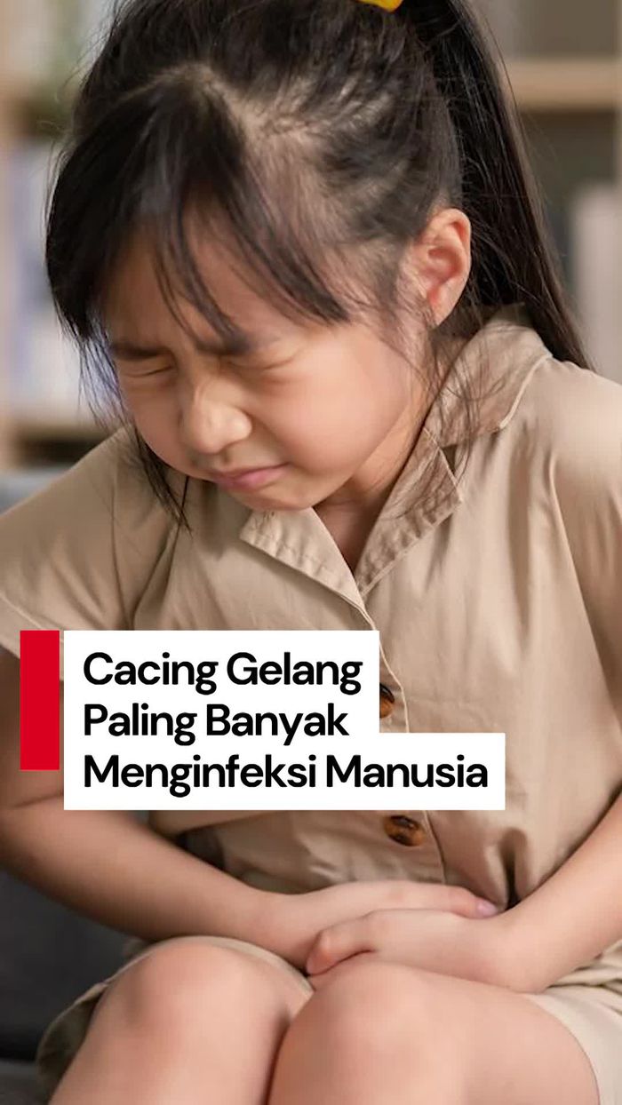 Video: Hampir 80 Persen Cacingan Gelang Terjadi pada Usia Sekolah