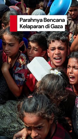 Video: Kelaparan di Gaza Makin Parah, 132 Ribu Anak Berisiko Meninggal