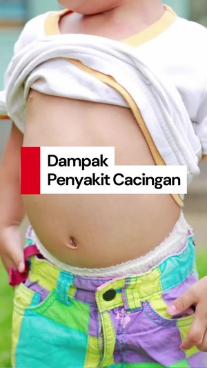 Video Dokter Ungkap Dampak Cacingan: Bisa Terjadi Stunting