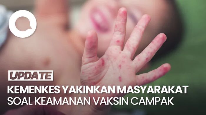Video Kemenkes: Jangan Takut Imunisasi, Vaksin Campak yang Kita Berikan Aman