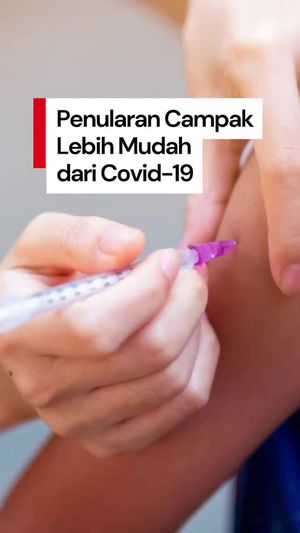 Video: Campak Lebih Menular dari Covid-19, IDAI Tekankan Pentingnya Imunisasi