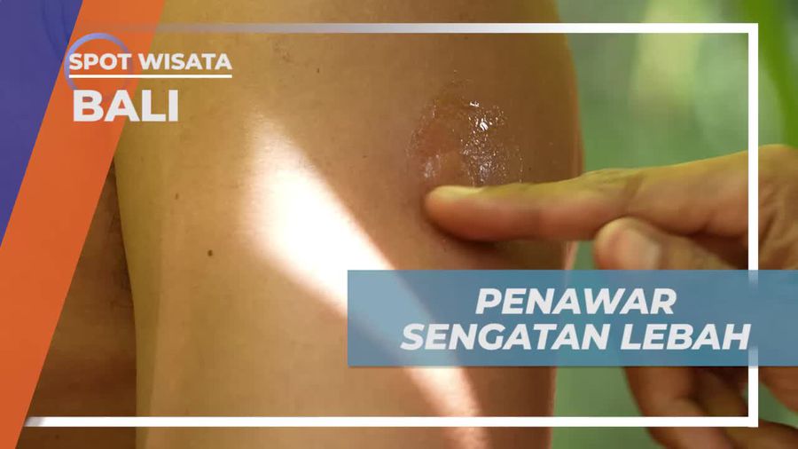 Menggunakan Madu Sebagai Penawar Sengatan Lebah dan Manfaat Kesehatannya di Bali  