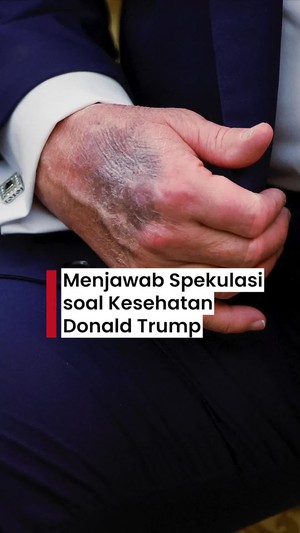 Video: Trump Buka Suara Terkait Spekulasi Kesehatannya