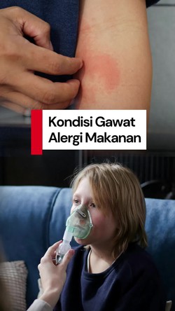 Video: Kondisi Anak Alergi Makanan yang Harus Segera Dibawa ke IGD