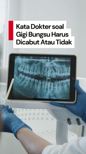 Video: Penjelasan Dokter soal Gigi Bungsu Harus Dicabut atau Tidak