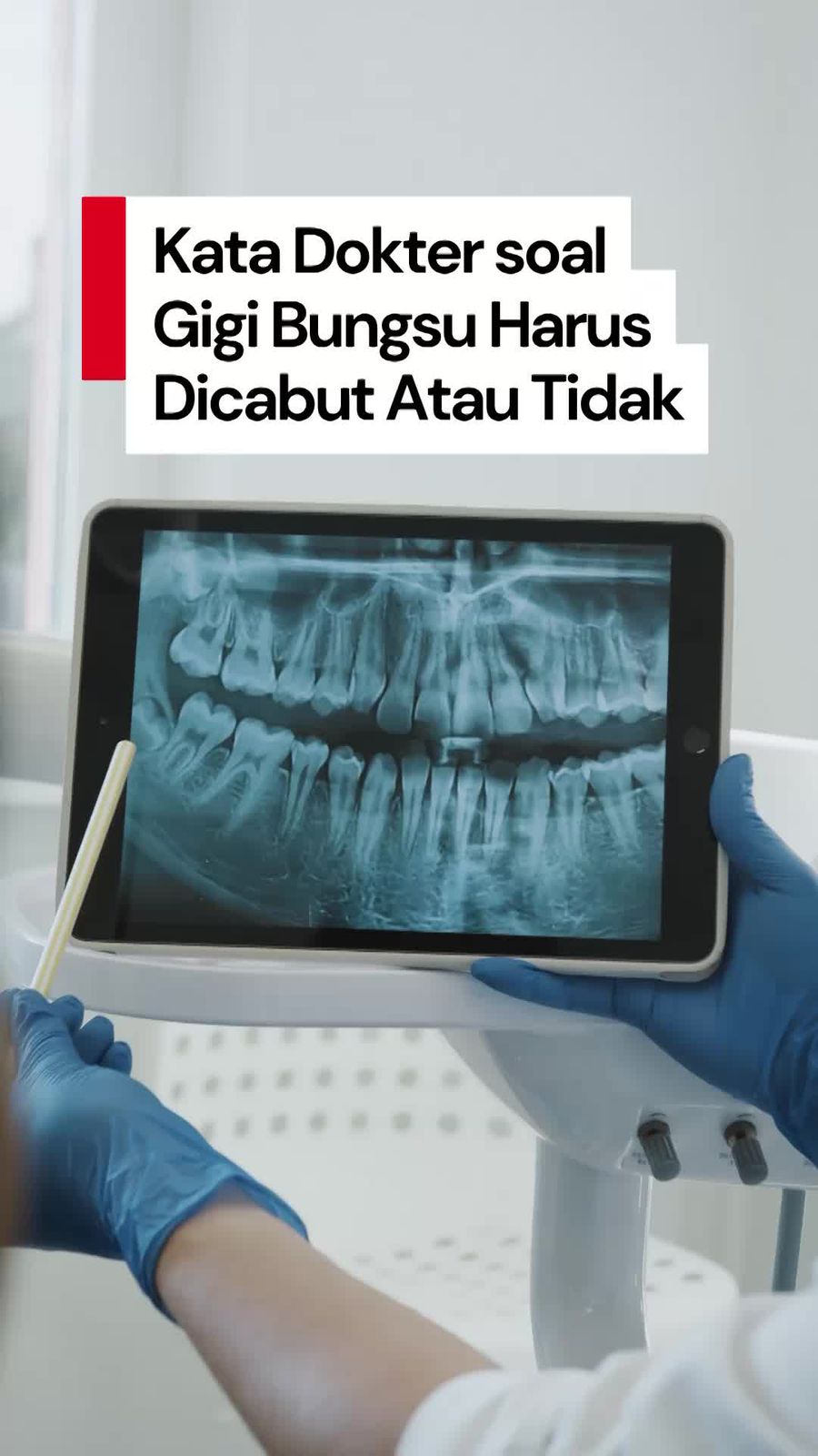 Video: Penjelasan Dokter soal Gigi Bungsu Harus Dicabut atau Tidak Video: Penjelasan Dokter soal Gigi Bungsu Harus Dicabut atau Tidak