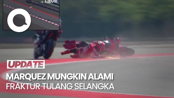 Video: Penjelasan Dokter soal Cedera Marc Marquez yang Crash di Mandalika