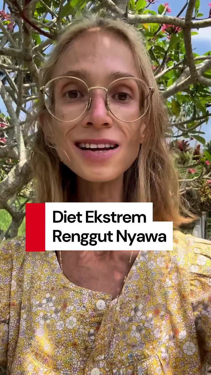 Video: Berat Badan Hanya 22 Kg, Wanita Ini Meninggal Usai Diet Ekstrem