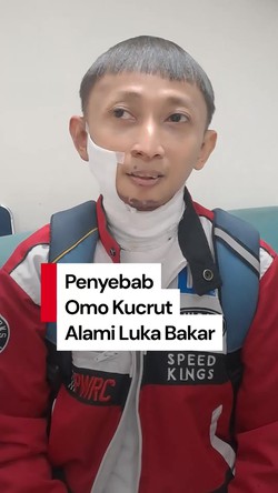 Video: Insiden yang Sebabkan Omo Kucrut Alami Luka Bakar di Wajah-Leher