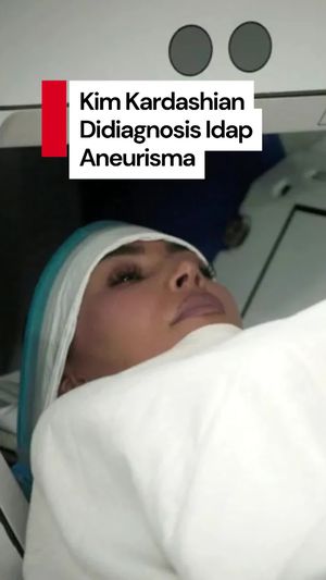 Video: Kim Kardashian Didiagnosis Aneurisma, Stres Berat Jadi Pemicunya