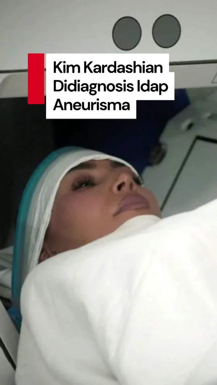 Video: Kim Kardashian Didiagnosis Aneurisma, Stres Berat Jadi Pemicunya