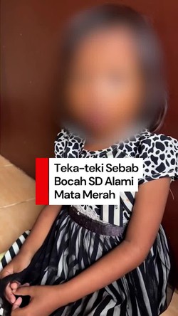 Video: Bocah SD Alami Mata Merah-Lebam di Palembang Jalani Pemeriksaan di RS