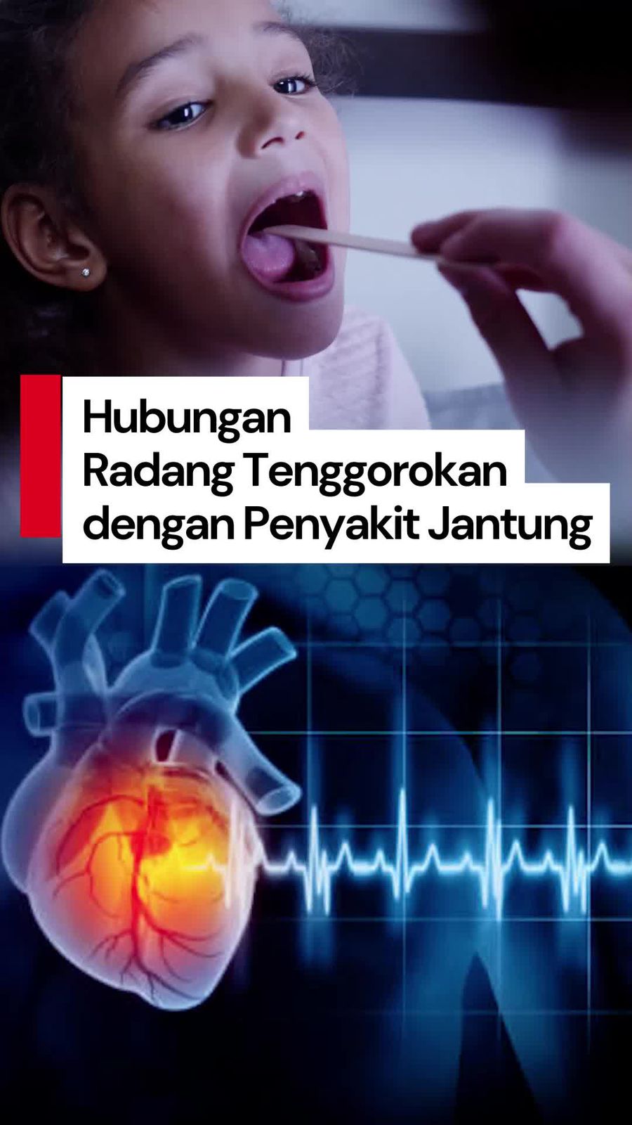 Video: Waspada! Radang Tenggorokan pada Anak Bisa Picu Penyakit Jantung