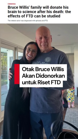 Video: Keluarga akan Donorkan Otak Bruce Willis untuk Riset Demensia