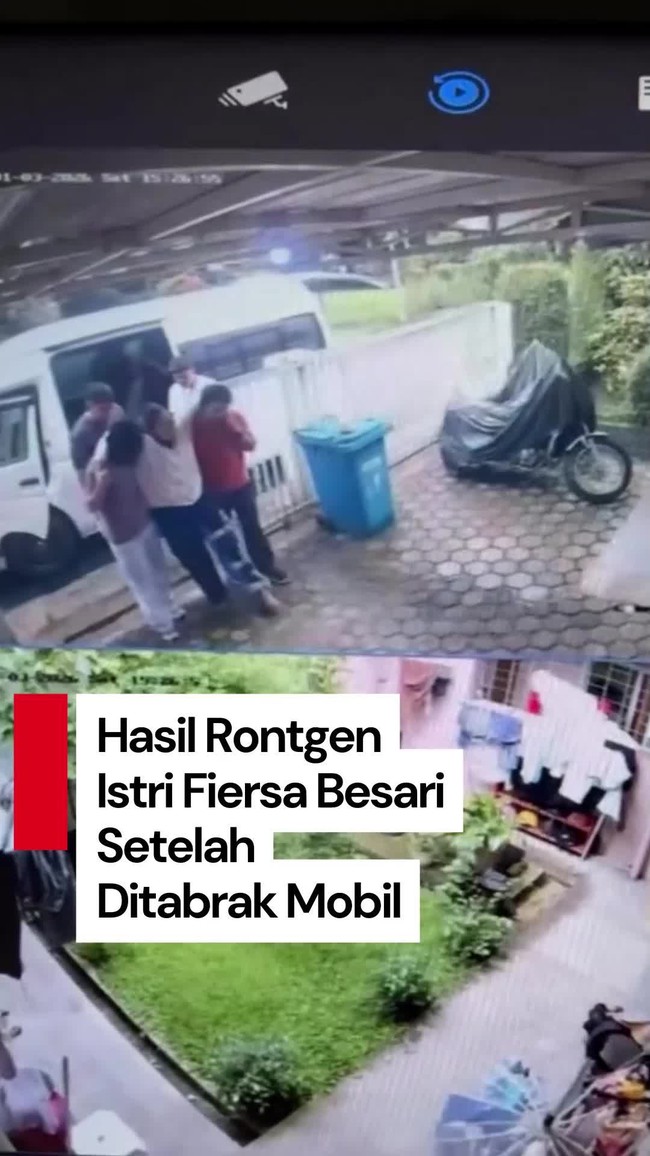 Video: Kondisi Istri Fiersa Besari Setelah Ditabrak Mobil dari Belakang