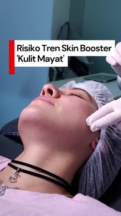 Video Risiko Tren Skin Booster Kulit Mayat: Picu Gangguan Penglihatan