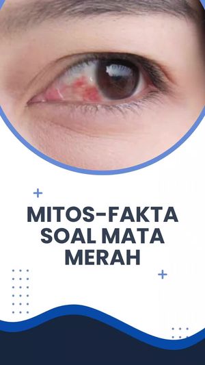 Video: Mitos Vs Fakta, Makan Wortel Bisa Cegah Mata Minus?