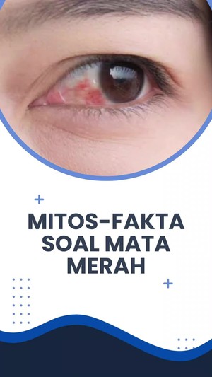 Video: Mitos Vs Fakta, Makan Wortel Bisa Cegah Mata Minus?